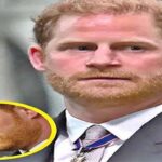 Prince Harry steps down from charity after ‘unthi/nkable’ controversy…